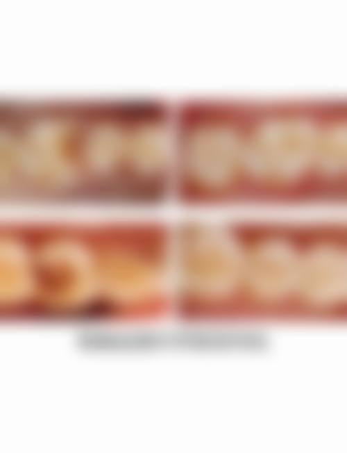 呼和浩特万诺口腔门诊部(万铭东汇分院)真实实例