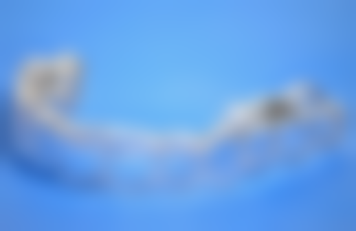 牙周状况不佳矫正牙齿不拔牙可行吗？