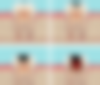 婴儿假性地包天矫正成效怎么样？