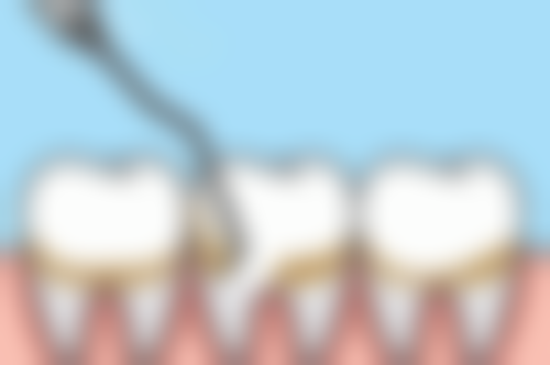 沈阳美莱医疗美容医院的牙齿美白妙招怎么样？