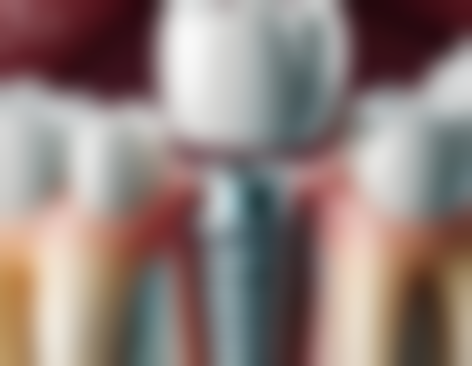 沈阳美莱医疗美容医院恒久补牙洞材料怎么样