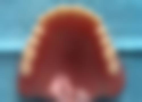 根管治疗不同阶段所需时间一样吗？