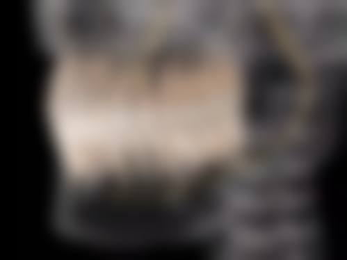 深圳同步同欢口腔门诊部仪器设备:精良科技助力治疗