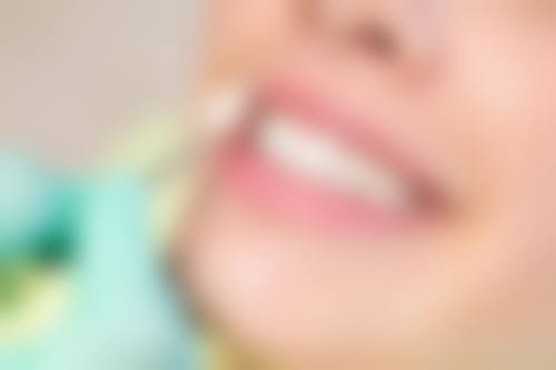 深圳同步同欢口腔门诊部真实实例:见证神奇的口腔变化