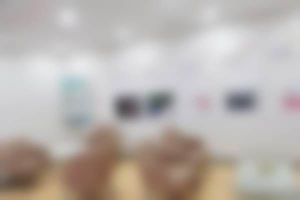 上海宏康医院口腔科 3M 唯美树脂补牙成功实例分享