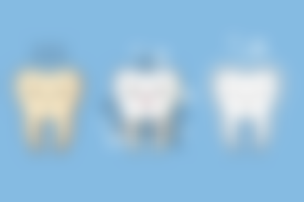 为什么洗牙会出血是怎么回事？了解这 3 大原因，掌握 4 个预防方法，让洗牙不再“惊心动魄”！ 