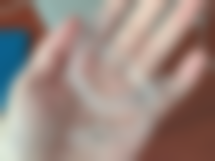 换牙期间地包天矫正的黄金时机是什么时候？