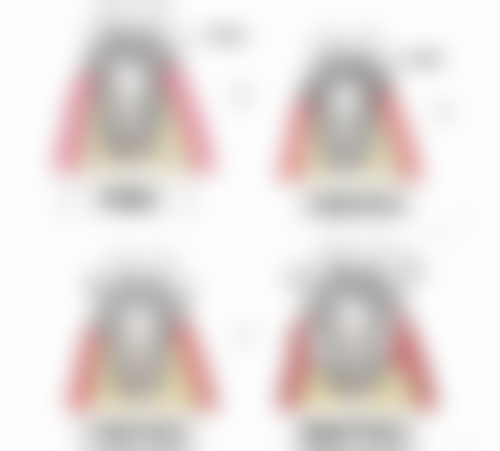 劲松口腔医院牙齿根管治疗后氧化锌类根管封闭剂适合吗