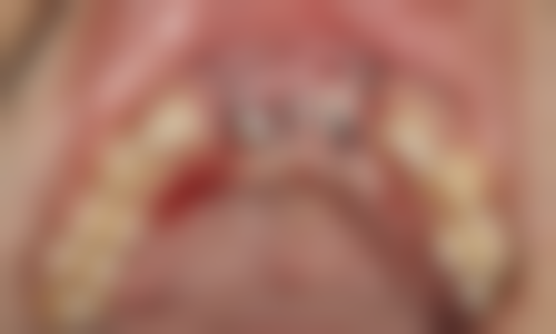 南宁牙萌萌口腔营业时间:随时为你服务