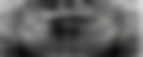 南宁蓝天口腔（西大店）真实实例：见证口腔蜕变奇迹