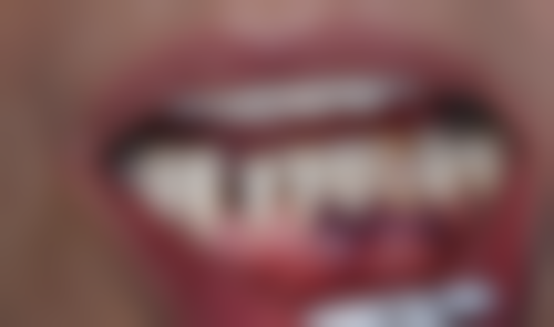 六盘水戴氏口腔医院擅长项目:满足你的多样需求