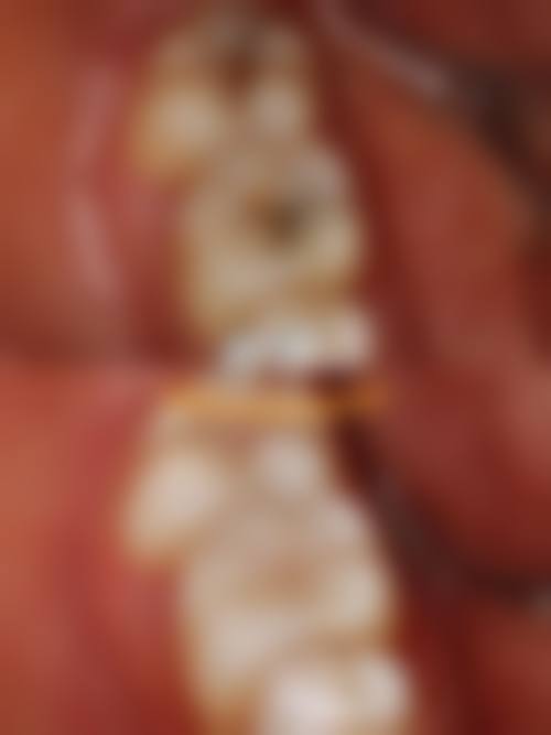 南宁蓝天口腔（西大店）擅长项目：口腔问题一网打尽