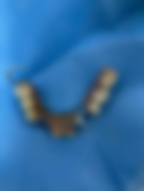 安徽滁州张如意口腔预约挂号方式:便捷效率高不等待