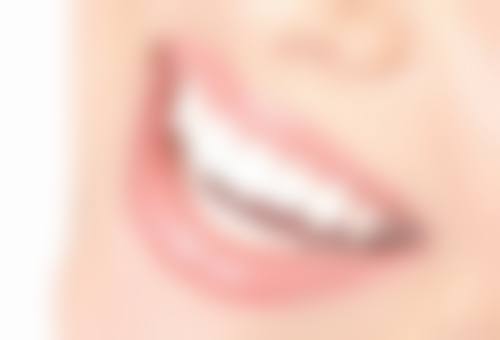 新疆伊宁瑞北雅齿口腔口碑怎么样