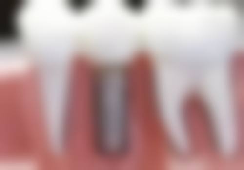 内蒙古呼伦贝尔牙克石利仁口腔门诊部口碑怎么样