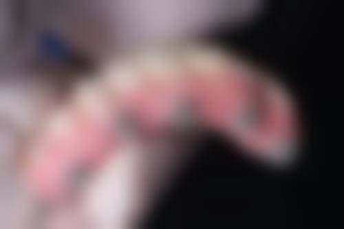 拔牙后渗血去非常爱美网合作医院处理适合吗？