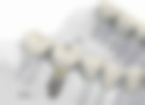 清木口腔门诊部口碑怎么样：患者的真实评价