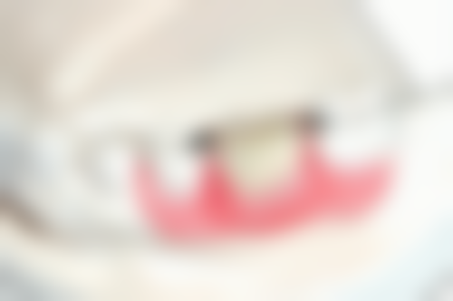 拔牙后选择冷食或温食怎么样？