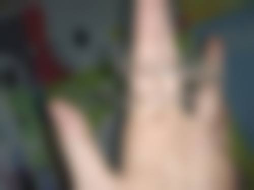 承德瑞邦口腔门诊部真实实例：见证神奇改变