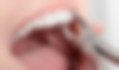 福建泉州乐莎莎口腔口碑怎么样：患者好评，实力见证