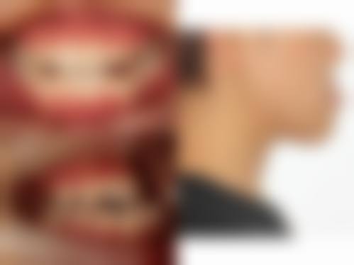 明光市中医院口腔科口碑怎么样：患者好评见证实力