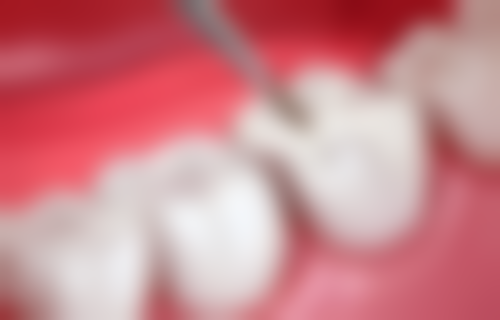 鄂尔多斯市口腔医院口碑怎么样