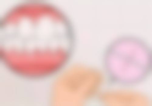 全瓷牙和全锆牙有什么区别？从材质、性能、价格深度剖析，哪款才是你的口腔“最佳拍档”？ 