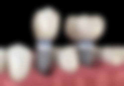 广州医 科 大学附属第三医院口腔科真实实例