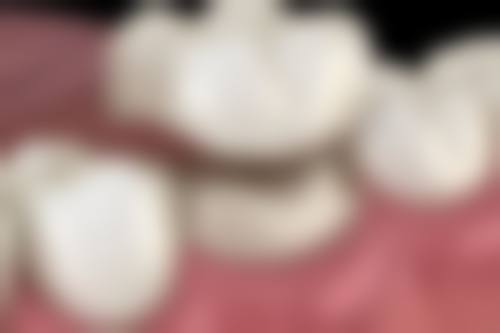 尹万洋医生真实实例