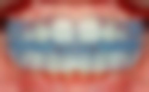 广州健拓口腔（南岗分院）真实实例