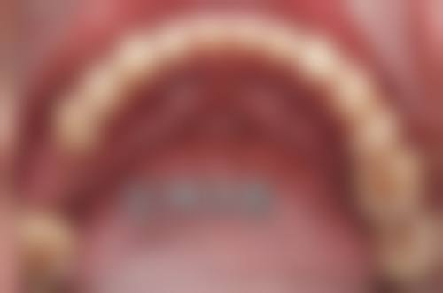 禹城刘仁滨口腔预约挂号方式：多种途径，轻松预约