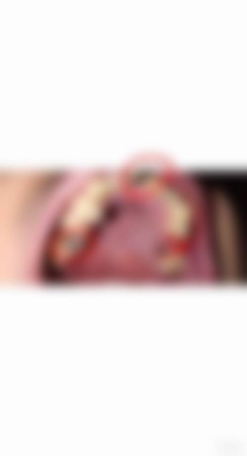 山东烟台尚英口腔门诊部价格表：合理收费，性价比高