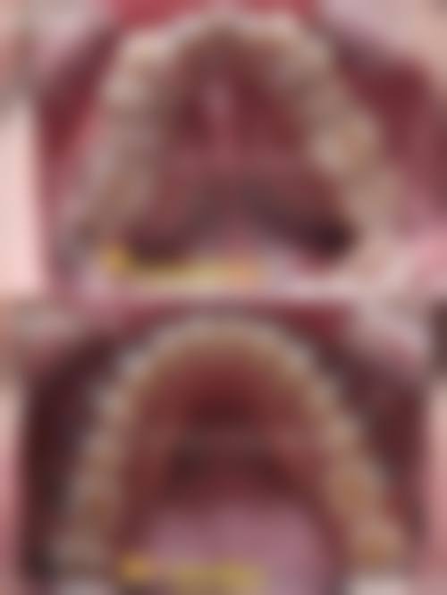 广州德伦口腔（车陂旗舰院）预约挂号方式