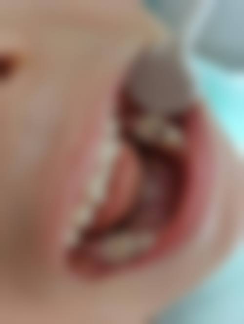 天津晧德口腔口碑怎么样：患者口中的“五星好评”