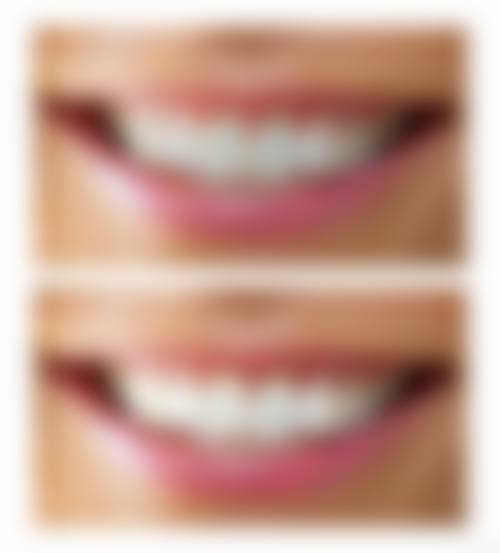 南京白特雅口腔门诊部擅长项目