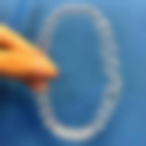 刚怀孕一个月补牙洞需要注意什么