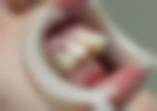 北京京大博爱口腔门诊部的刘婧医生做正畸适合吗