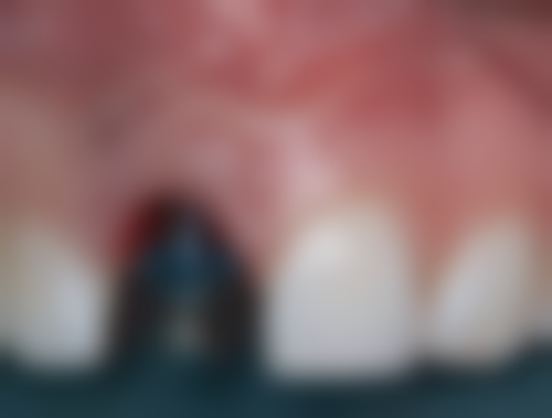 长沙微美口腔地址及乘车路线：轻松找到目的地