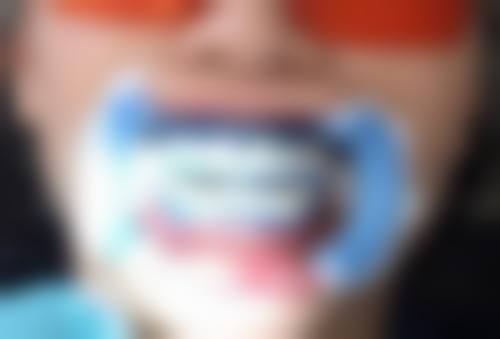 种植牙植入种植体适合所有人吗