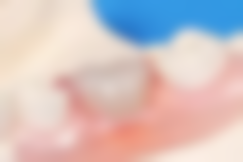 舟山爱雅仕口腔擅长项目：满足多样口腔需求