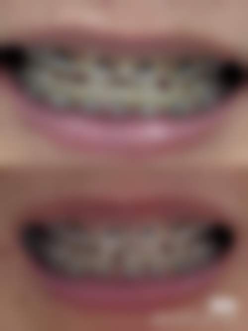 台州中一口腔诊所预约挂号方式