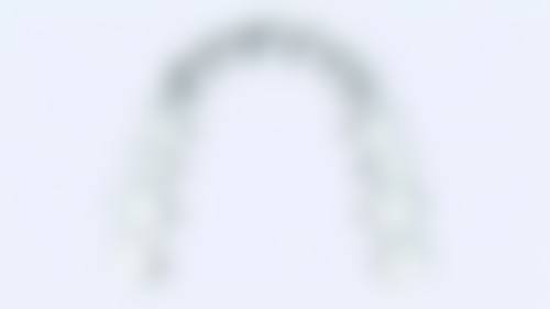 深圳刘震口腔诊所仪器设备：精良科技助力治疗