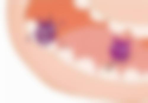 玻璃离子补牙适合哪些情况？