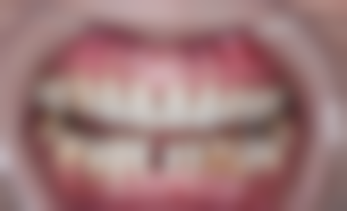 镇江扬中精诚口腔门诊部地址及乘车路线：轻松找到就诊地