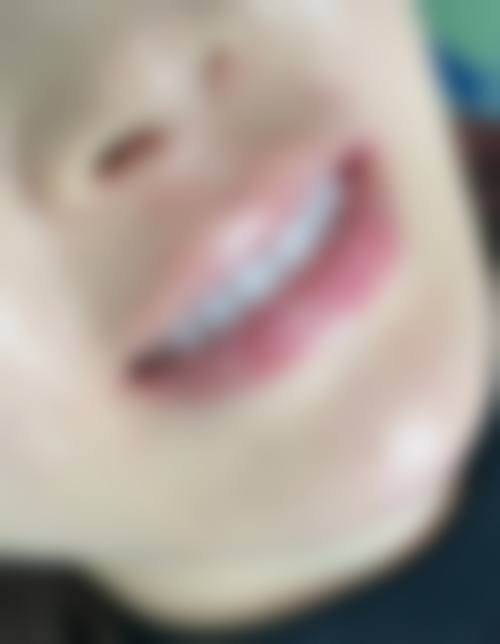 山东济南天桥铭仁口腔预约挂号方式：便捷又效率高