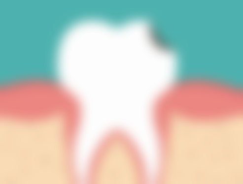 根管治疗的质量对做过根管治疗的牙能用多久有多大关系