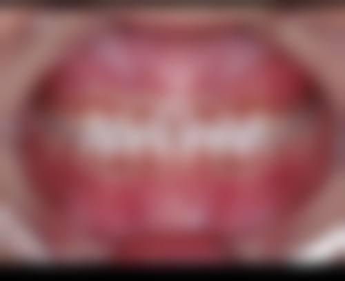 余姚恩典口腔诊所擅长项目