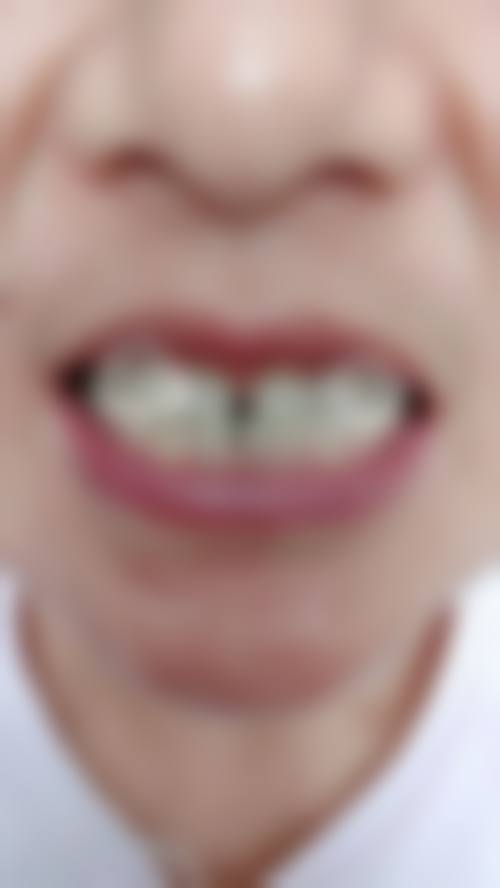 深圳佑诺口腔执业信息：正规靠谱有保护