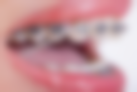 浙江衢州壹号植牙电话号码