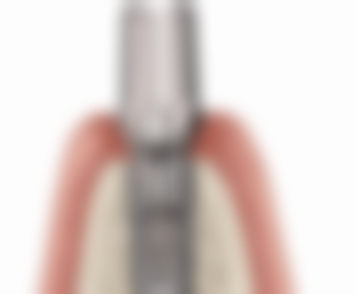 王志宏医生技术特点